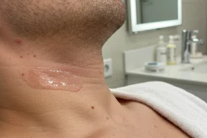 Men’s Grooming: Waxing Beats Razor Burn in 2026