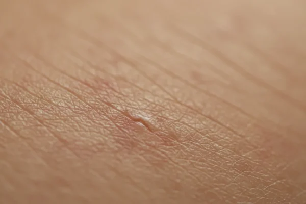 Shaving Cream Use: 78% of Men Risk Skin in 2026